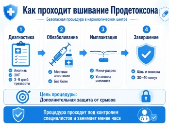 Имплантация Продетоксон в Камышлове